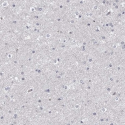 GPRC5C Antibody, Novus Biologicals 25 &mu;L; Unlabeled:Antibodies, Polyclonal