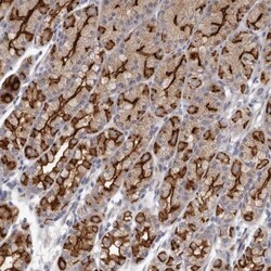 GPRC5C Antibody, Novus Biologicals 25 &mu;L; Unlabeled:Antibodies, Polyclonal