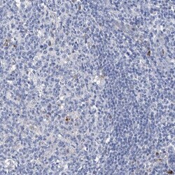 GPT Antibody, Novus Biologicals 0.1mL; Unlabeled:Antibodies, Polyclonal