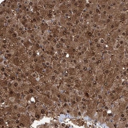 GPT Antibody, Novus Biologicals:Antibodies:Primary Antibodies