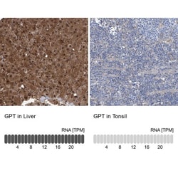 GPT Antibody, Novus Biologicals:Antibodies:Primary Antibodies
