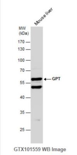 GPT Antibody, Novus Biologicals 0.1mL; Unlabeled:Antibodies, Polyclonal