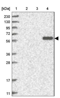 GPT Antibody, Novus Biologicals 0.1mL; Unlabeled:Antibodies, Polyclonal