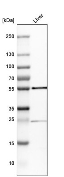 GPT Antibody, Novus Biologicals:Antibodies:Primary Antibodies