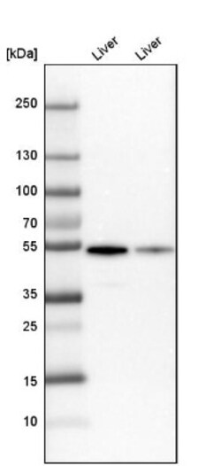 GPT Antibody, Novus Biologicals:Antibodies:Primary Antibodies