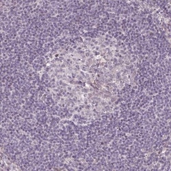 GPT2 Antibody, Novus Biologicals 25ul | Buy Online | Novus Biologicals | Fisher Scientific