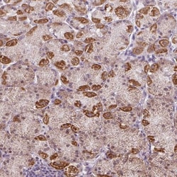 GPT2 Antibody, Novus Biologicals 25ul | Buy Online | Novus Biologicals | Fisher Scientific