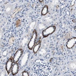GRAMD1A Antibody, Novus Biologicals:Antibodies:Primary Antibodies