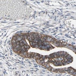 GRAMD3 Antibody, Novus Biologicals 0.1mL; Unlabeled:Antibodies, Polyclonal