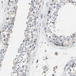 GRAMD3 Antibody, Novus Biologicals 0.1mL; Unlabeled:Antibodies, Polyclonal