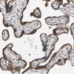 GRAMD3 Antibody, Novus Biologicals:Antibodies:Primary Antibodies
