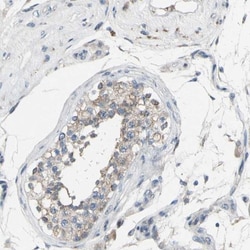 GRAMD3 Antibody, Novus Biologicals:Antibodies:Primary Antibodies