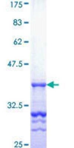 Novus Biologicals Recombinant Human GRB10 GST (N-Term) Protein 25 &mu;g | Buy Online | Novus Biologicals&trade; | Fisher Scientific