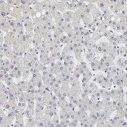 GRHL2 Antibody, Novus Biologicals 0.1mL; Unlabeled:Antibodies, Polyclonal