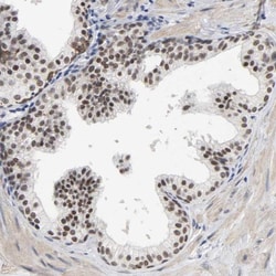 GRHL2 Antibody, Novus Biologicals 0.1mL; Unlabeled:Antibodies, Polyclonal