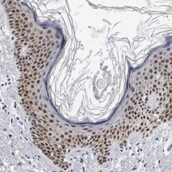 GRHL2 Antibody, Novus Biologicals 0.1mL; Unlabeled:Antibodies, Polyclonal