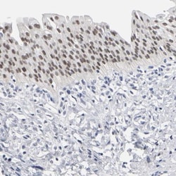 GRHL2 Antibody, Novus Biologicals 0.1mL; Unlabeled:Antibodies, Polyclonal