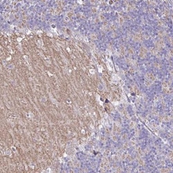 GRID2 Antibody, Novus Biologicals 0.1mL; Unlabeled:Antibodies, Polyclonal