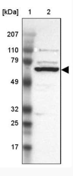 GRK3 Antibody, Novus Biologicals 25 &mu;L | Buy Online | Novus Biologicals | Fisher Scientific
