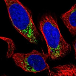 GRK6 Antibody, Novus Biologicals:Antibodies:Primary Antibodies