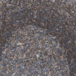 GRK6 Antibody, Novus Biologicals:Antibodies:Primary Antibodies