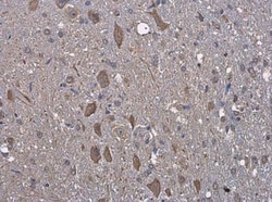 GRP78/HSPA5 Antibody, Novus Biologicals 0.1mL; Unlabeled:Antibodies, Polyclonal
