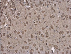 GRP78/HSPA5 Antibody, Novus Biologicals 0.1mL; Unlabeled:Antibodies, Polyclonal