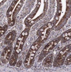 GRPEL1 Antibody, Novus Biologicals 25 &mu;L; Unlabeled:Antibodies, Polyclonal