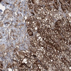 GRSF1 Antibody, Novus Biologicals:Antibodies:Primary Antibodies