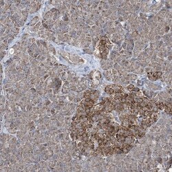 GRSF1 Antibody, Novus Biologicals:Antibodies:Primary Antibodies