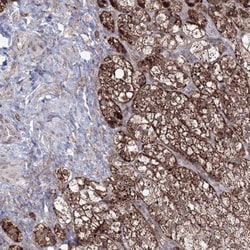 GRSF1 Antibody, Novus Biologicals 0.1mL; Unlabeled:Antibodies, Polyclonal