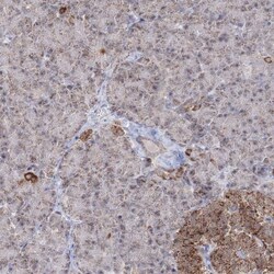 GRSF1 Antibody, Novus Biologicals 0.1mL; Unlabeled:Antibodies, Polyclonal
