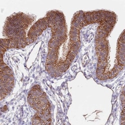 GSDMDC1 Antibody, Novus Biologicals 0.1mL; Unlabeled:Antibodies, Polyclonal