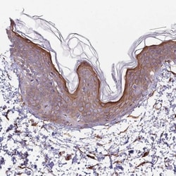 GSDMDC1 Antibody, Novus Biologicals 0.1mL; Unlabeled:Antibodies, Polyclonal