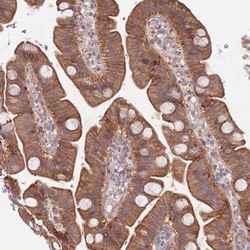 GSDMDC1 Antibody, Novus Biologicals 0.1mL; Unlabeled:Antibodies, Polyclonal