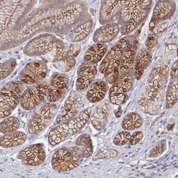 GSDMDC1 Antibody, Novus Biologicals 0.1mL; Unlabeled:Antibodies, Polyclonal