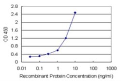 Novus Biologicals GSDMDC1 Antibody Pair 1 Set | Buy Online | Novus Biologicals&trade; | Fisher Scientific