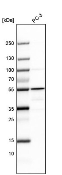 GSDMDC1 Antibody, Novus Biologicals 0.1mL; Unlabeled:Antibodies, Polyclonal