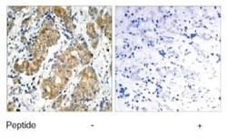 GSK-3 alpha Antibody, Novus Biologicals 0.1 mg; Unconjugated:Antibodies,