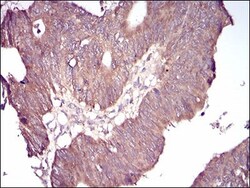 GSK-3 beta Antibody (3D6B4) - BSA Free, Novus Biologicals 0.1mg; Unlabeled:Antibodies,