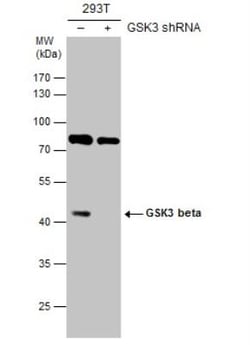 GSK-3 beta Antibody, Novus Biologicals 100 &mu;L | Buy Online | Novus Biologicals | Fisher Scientific