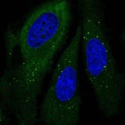 GSPT1 Antibody, Novus Biologicals 0.1mL; Unlabeled:Antibodies, Polyclonal