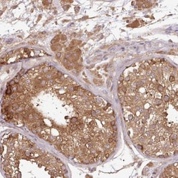 GSPT1 Antibody, Novus Biologicals 0.1mL; Unlabeled:Antibodies, Polyclonal