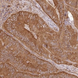 GSPT1 Antibody, Novus Biologicals 0.1mL; Unlabeled:Antibodies, Polyclonal