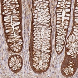 GSPT1 Antibody, Novus Biologicals 0.1mL; Unlabeled:Antibodies, Polyclonal