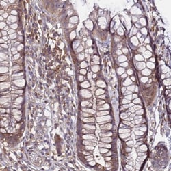 GSPT2 Antibody, Novus Biologicals 0.1mL; Unlabeled:Antibodies, Polyclonal