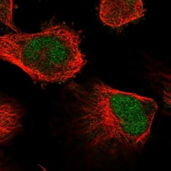 GSTCD Antibody, Novus Biologicals 0.1mL; Unlabeled:Antibodies, Polyclonal