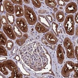 GSTCD Antibody, Novus Biologicals 0.1mL; Unlabeled:Antibodies, Polyclonal