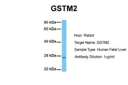 GSTM2 Antibody, Novus Biologicals 0.05mg; Unlabeled:Antibodies, Polyclonal