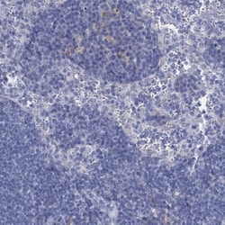 GSTM3 Antibody, Novus Biologicals:Antibodies:Primary Antibodies